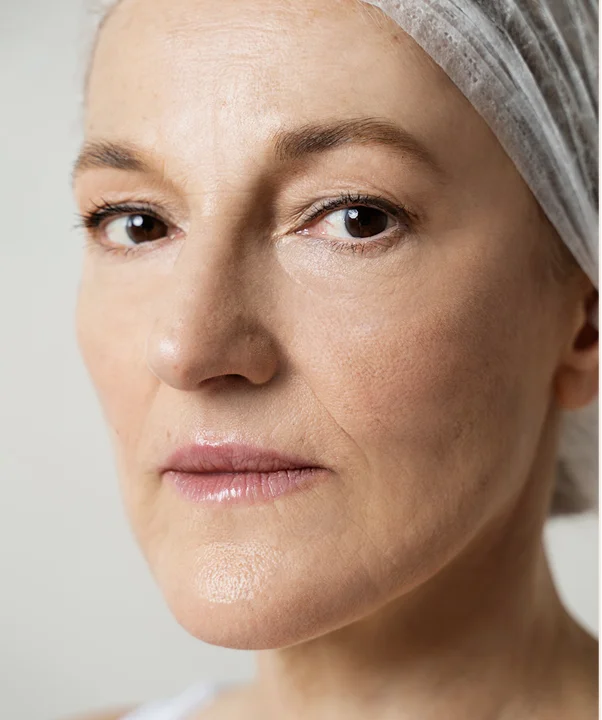 Bespoke Ombré & Microblading Brows After